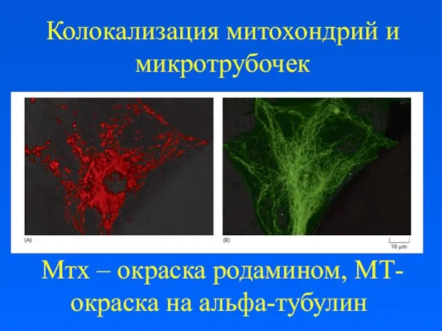 Колокализация митохондрий и микротрубочек Мтх – окраска родамином, МТ- окраска на альфа-тубулин