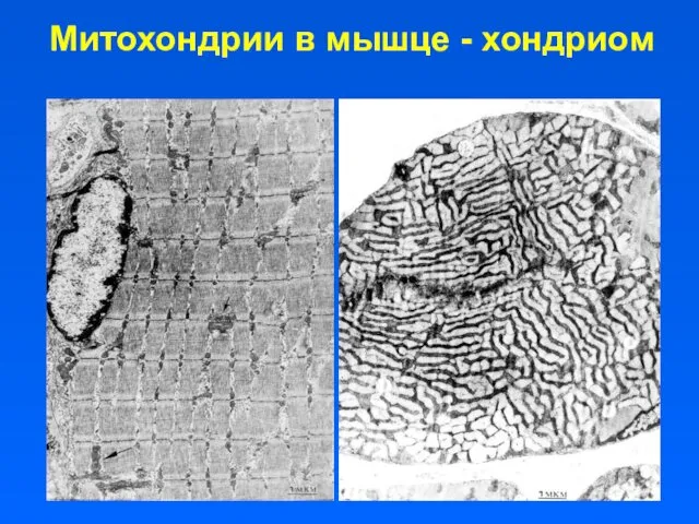 Митохондрии в мышце - хондриом