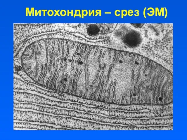 Митохондрия – срез (ЭМ)