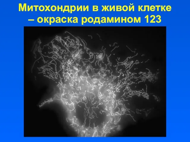 Митохондрии в живой клетке – окраска родамином 123