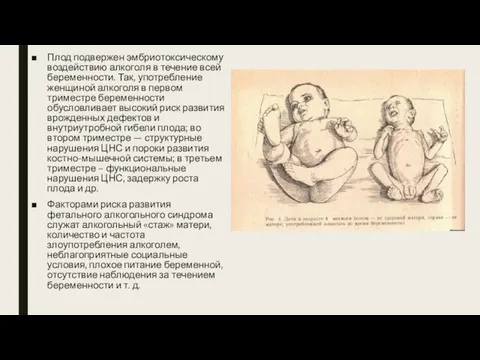 Плод подвержен эмбриотоксическому воздействию алкоголя в течение всей беременности. Так, употребление