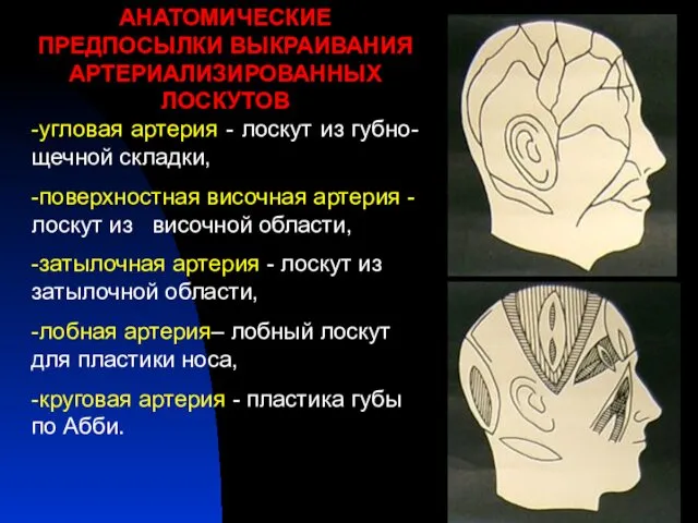 АНАТОМИЧЕСКИЕ ПРЕДПОСЫЛКИ ВЫКРАИВАНИЯ АРТЕРИАЛИЗИРОВАННЫХ ЛОСКУТОВ -угловая артерия - лоскут из губно-щечной