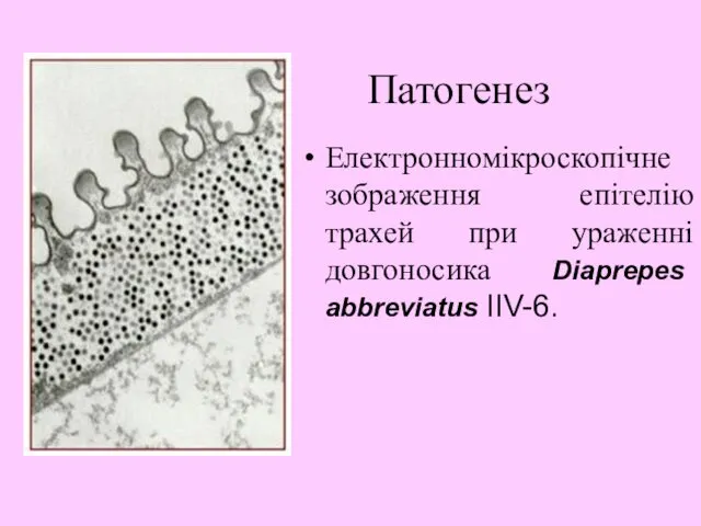 Патогенез Електронномікроскопічне зображення епітелію трахей при ураженні довгоносика Diaprepes abbreviatus IIV-6.