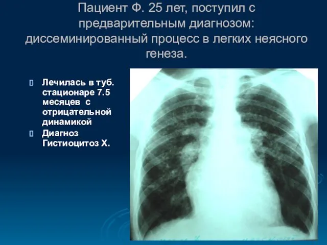 Пациент Ф. 25 лет, поступил с предварительным диагнозом: диссеминированный процесс в