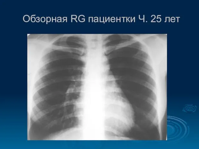 Обзорная RG пациентки Ч. 25 лет