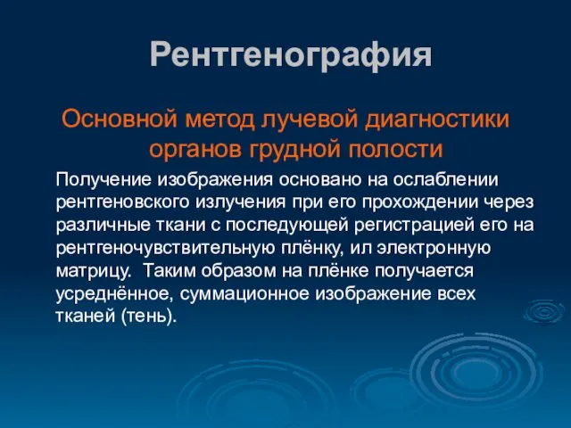 Рентгенография Основной метод лучевой диагностики органов грудной полости Получение изображения основано