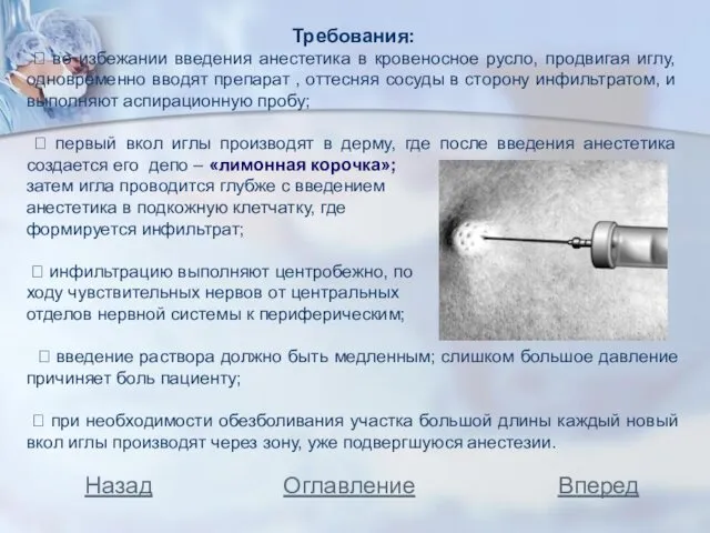 Требования: ⮲ во избежании введения анестетика в кровеносное русло, продвигая иглу,