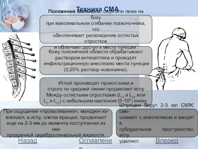 Техника СМА Назад Вперед Оглавление