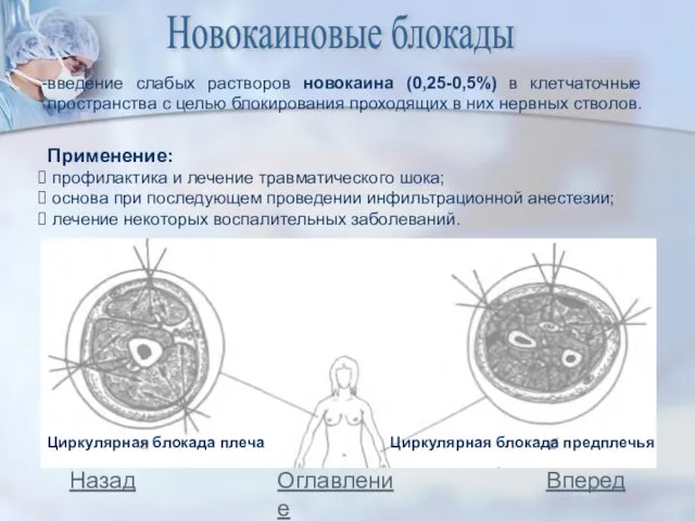 Новокаиновые блокады введение слабых растворов новокаина (0,25-0,5%) в клетчаточные пространства с