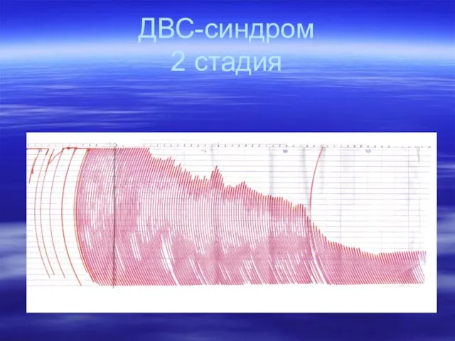 ДВС-синдром 2 стадия