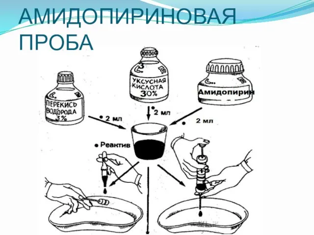 АМИДОПИРИНОВАЯ ПРОБА