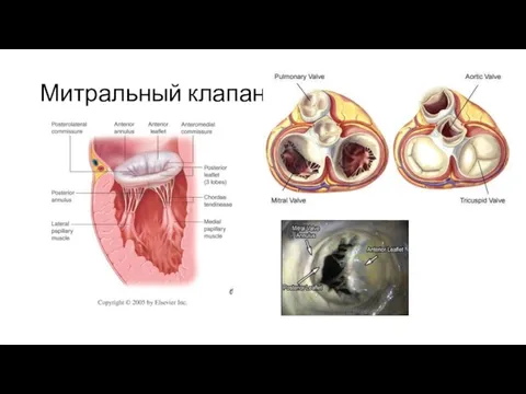 Митральный клапан