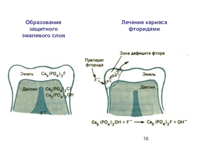 Образование защитного эмалевого слоя Лечение кариеса фторидами