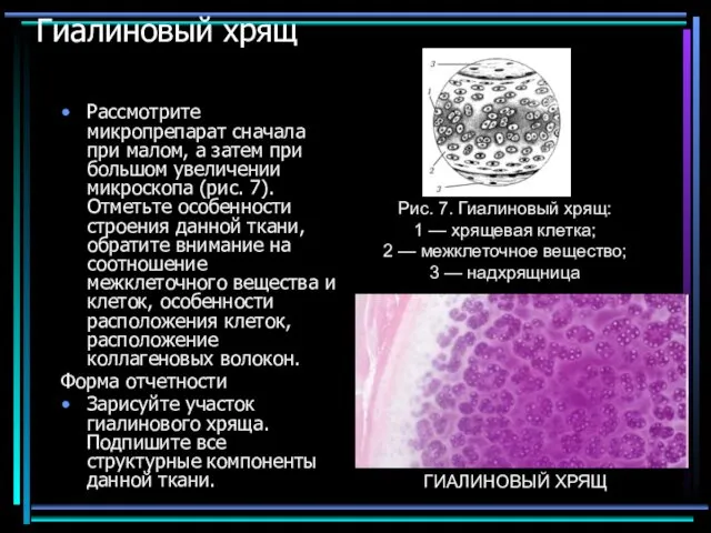 Гиалиновый хрящ Рассмотрите микропрепарат сначала при малом, а затем при большом