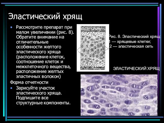 Эластический хрящ Рассмотрите препарат при малом увеличении (рис. 8). Обратите внимание