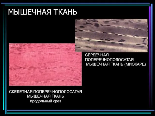 МЫШЕЧНАЯ ТКАНЬ СКЕЛЕТНАЯ ПОПЕРЕЧНОПОЛОСАТАЯ МЫШЕЧНАЯ ТКАНЬ продольный срез СЕРДЕЧНАЯ ПОПЕРЕЧНОПОЛОСАТАЯ МЫШЕЧНАЯ ТКАНЬ (МИОКАРД)