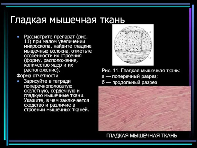 Гладкая мышечная ткань Рассмотрите препарат (рис. 11) при малом увеличении микроскопа,