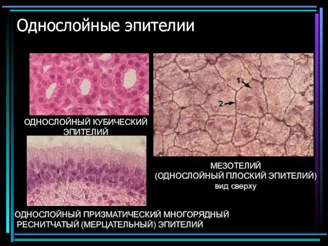 Однослойные эпителии ОДНОСЛОЙНЫЙ КУБИЧЕСКИЙ ЭПИТЕЛИЙ МЕЗОТЕЛИЙ (ОДНОСЛОЙНЫЙ ПЛОСКИЙ ЭПИТЕЛИЙ) вид сверху