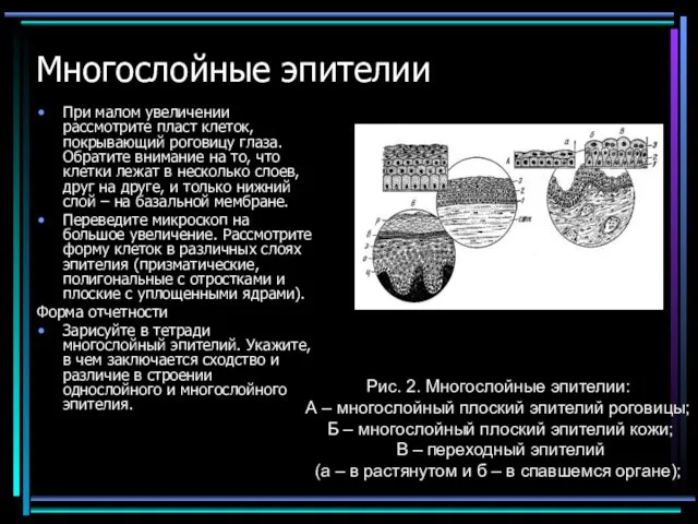 Многослойные эпителии При малом увеличении рассмотрите пласт клеток, покрывающий роговицу глаза.