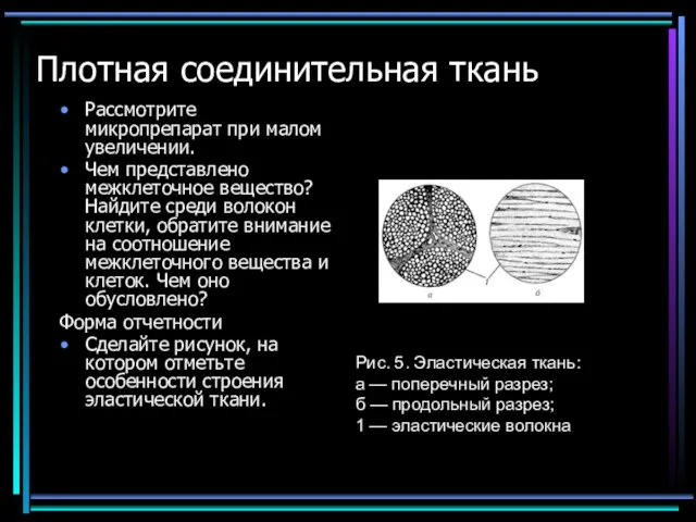 Плотная соединительная ткань Рассмотрите микропрепарат при малом увеличении. Чем представлено межклеточное