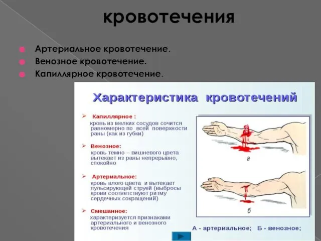 кровотечения Артериальное кровотечение. Венозное кровотечение. Капиллярное кровотечение.