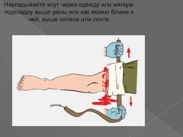 Накладывайте жгут через одежду или мягкую подкладку выше раны или как