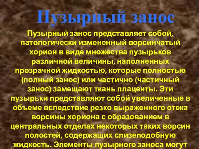 Пузырный занос Пузырный занос представляет собой, патологически измененный ворсинчатый хорион в