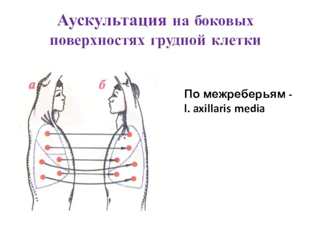 Аускультация на боковых поверхностях грудной клетки По межреберьям - l. axillaris media