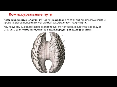 Комиссуральные пути Комиссуральные (спаечные) нервные волокна соединяют одинаковые центры правой и