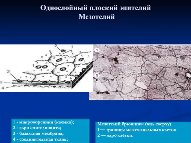 Мезотелий брюшины (вид сверху) 1 — границы мезотелиальных клеток 2 —