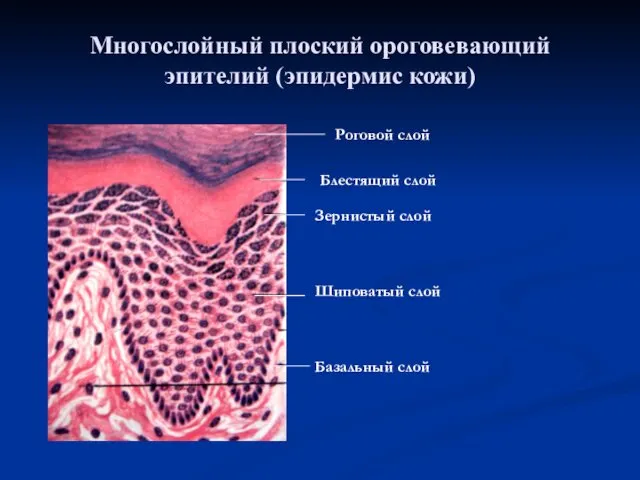 Многослойный плоский ороговевающий эпителий (эпидермис кожи) Базальный слой Шиповатый слой Зернистый слой Блестящий слой Роговой слой