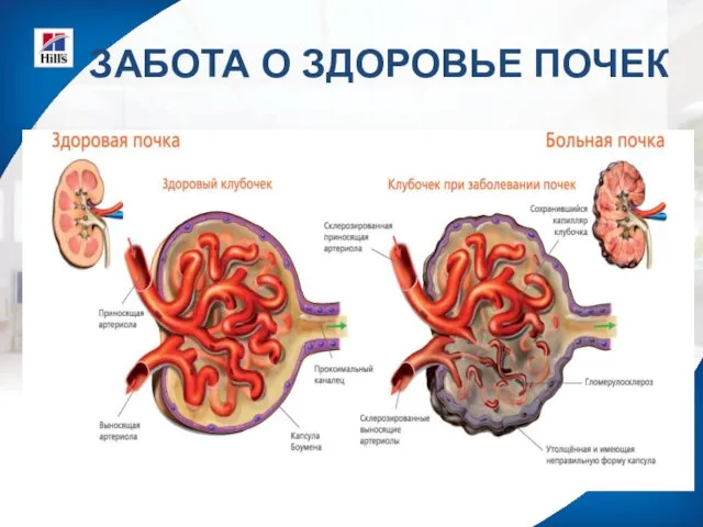 ЗАБОТА О ЗДОРОВЬЕ ПОЧЕК