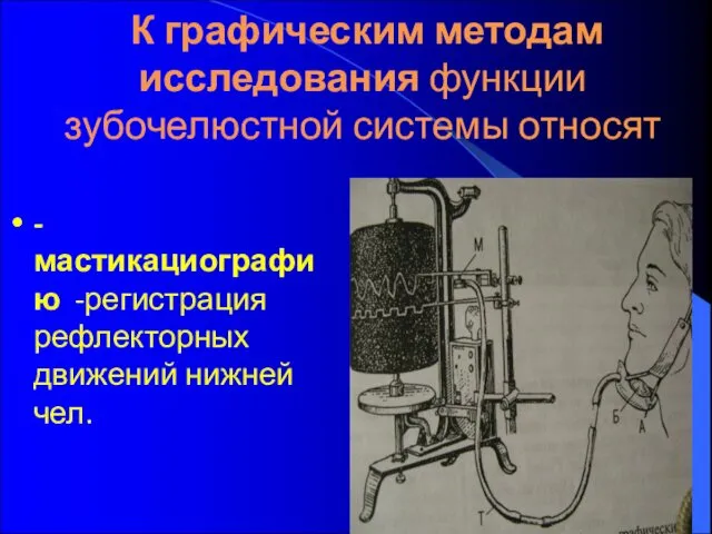 К графическим методам исследования функции зубочелюстной системы относят -мастикациографию -регистрация рефлекторных движений нижней чел.