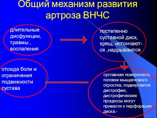 Общий механизм развития артроза ВНЧС длительные дисфункции, травмы , воспаления постепенно