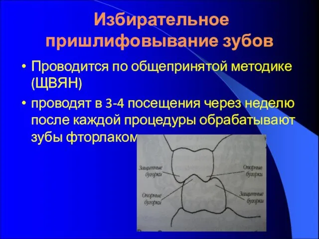 Избирательное пришлифовывание зубов Проводится по общепринятой методике (ЩВЯН) проводят в 3-4