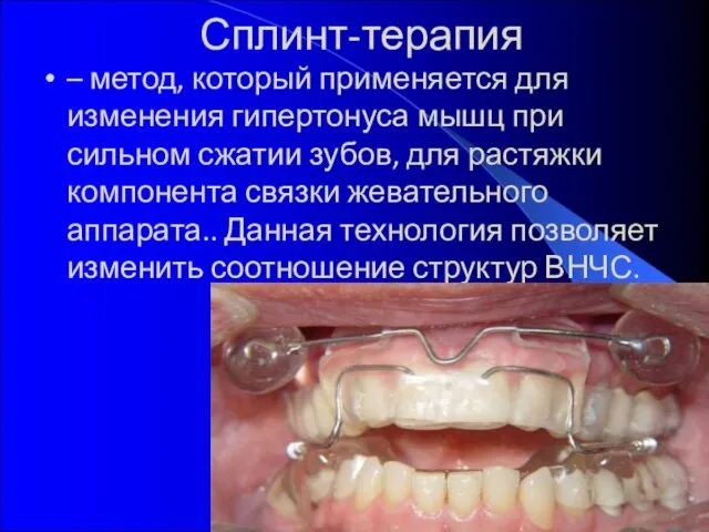 Сплинт-терапия – метод, который применяется для изменения гипертонуса мышц при сильном