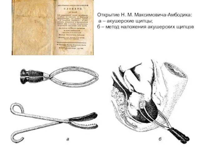 Открытие Н. М. Максимовича-Амбодика: а – акушерские щипцы; б – метод наложения акушерских щипцов