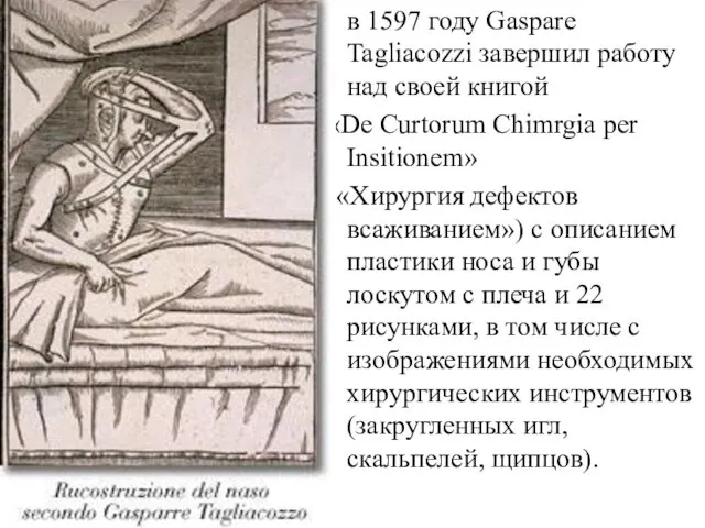 в 1597 году Gaspare Tagliacozzi завершил работу над своей книгой «De