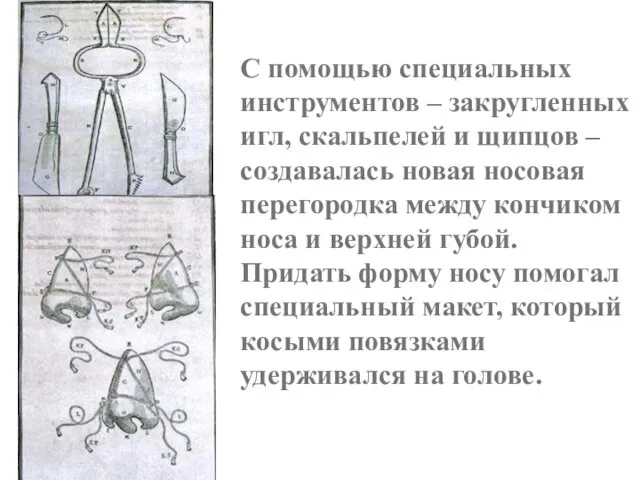 С помощью специальных инструментов – закругленных игл, скальпелей и щипцов –