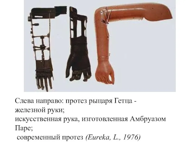 Слева направо: протез рыцаря Гетца - железной руки; искусственная рука, изготовленная