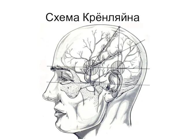 Схема Крёнляйна