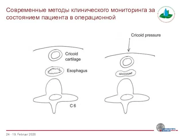 Современные методы клинического мониторинга за состоянием пациента в операционной · 19. Februar 2020