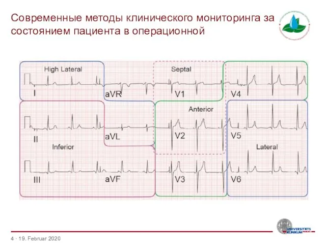 Современные методы клинического мониторинга за состоянием пациента в операционной · 19. Februar 2020