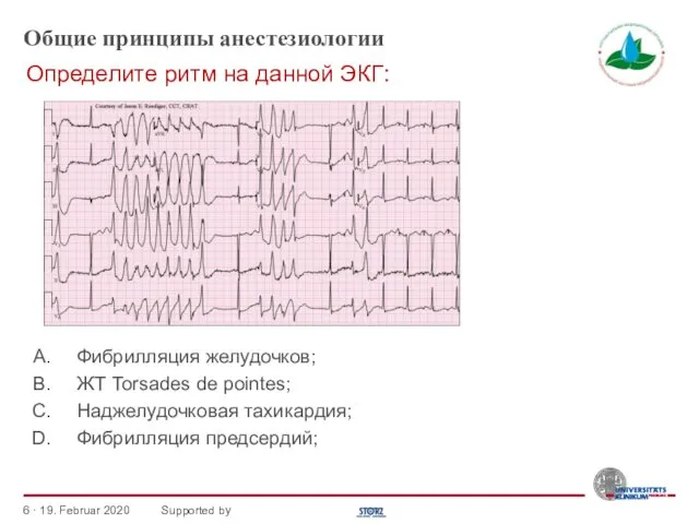 Общие принципы анестезиологии Фибрилляция желудочков; ЖТ Torsades de pointes; Наджелудочковая тахикардия;