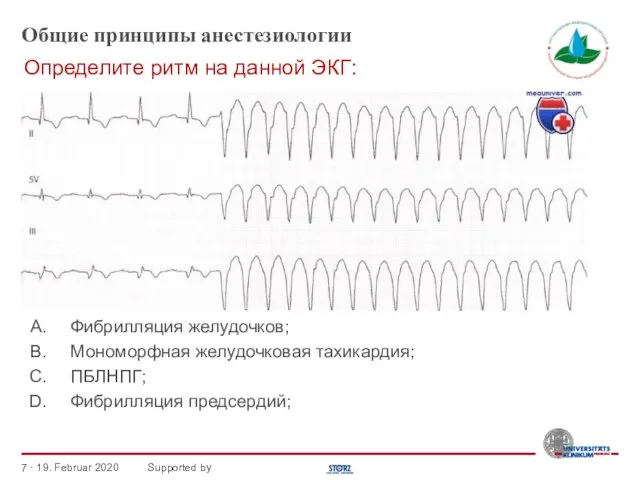 Общие принципы анестезиологии Фибрилляция желудочков; Мономорфная желудочковая тахикардия; ПБЛНПГ; Фибрилляция предсердий;