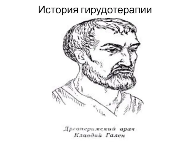 История гирудотерапии