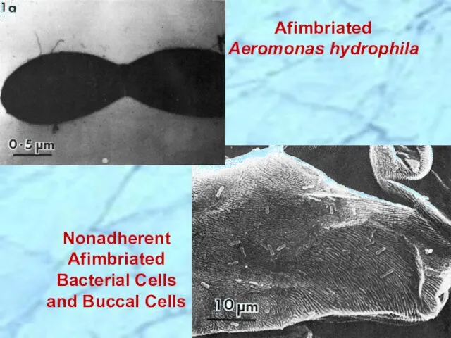 Afimbriated Aeromonas hydrophila Nonadherent Afimbriated Bacterial Cells and Buccal Cells