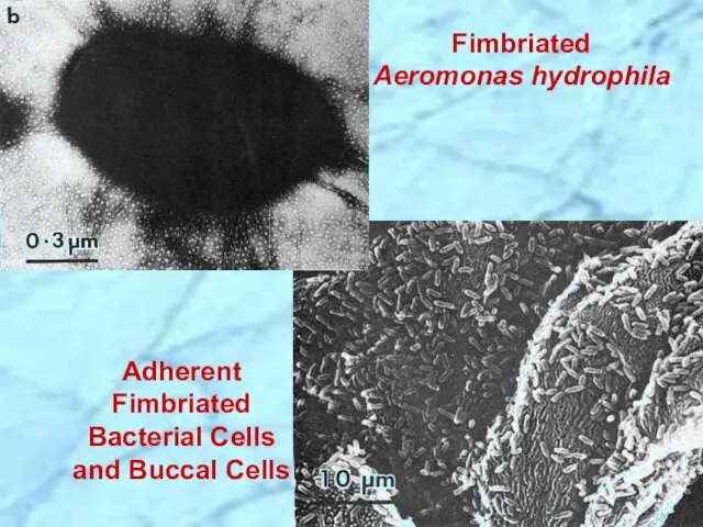 Adherent Fimbriated Bacterial Cells and Buccal Cells Fimbriated Aeromonas hydrophila