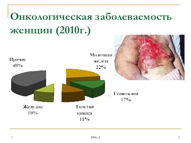 * ВМедА Онкологическая заболеваемость женщин (2010г.)