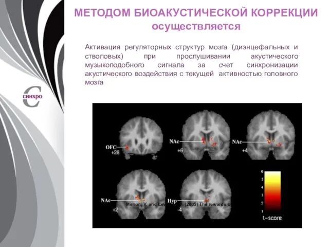 МЕТОДОМ БИОАКУСТИЧЕСКОЙ КОРРЕКЦИИ осуществляется Активация регуляторных структур мозга (диэнцефальных и стволовых)